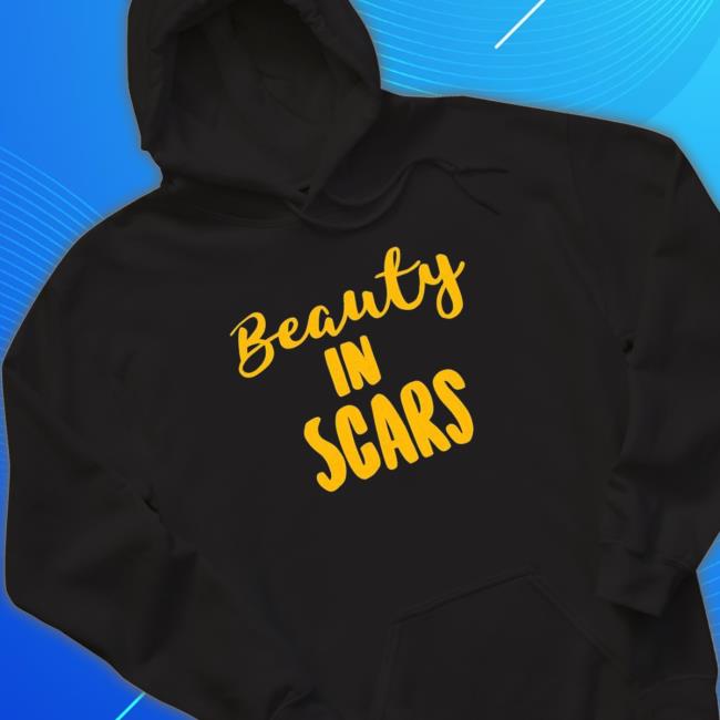 Beauty In Scars shirt, hoodie, tank top, sweater and long sleeve t-shirt Beauty In Scars shirt, hoodie, tank top, sweater and long sleeve t-shirt
